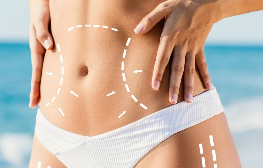 What to Know About Post-Body Contouring in Dubai: Skin Care and Maintenance